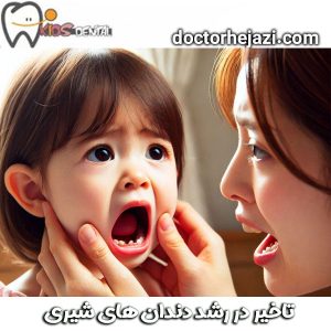 تاخیر در رشد دندان های شیری از دکتر ماندانا حجازی بهترین دندانپزشک کودکان در تهران