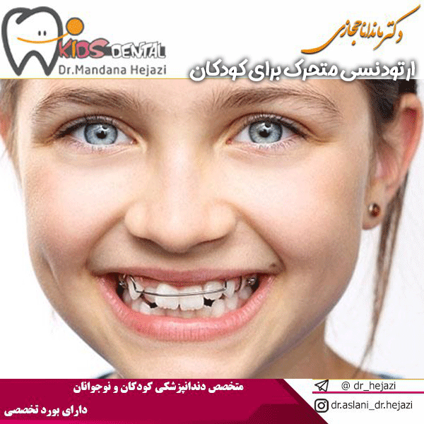 ارتودنسی متحرک برای کودکان