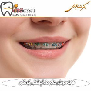 هزینه درمان های ارتودنسی کودکان