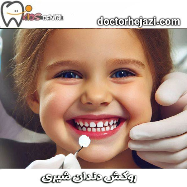 روکش دندان شیری از دکتر ماندانا حجازی ، بهترین دندانپزشک کودکان در تهران