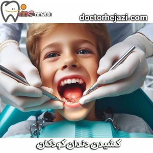 کشیدن دندان کودکان از دکتر ماندانا حجازی ، بهترین متخصص دندانپزشکی کودکان تهران 