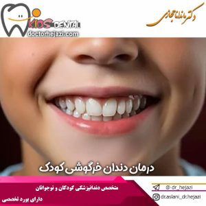 درمان دندان خرگوشی کودک