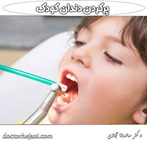 پر کردن دندان کودک ، دکتر حجازی در تهران