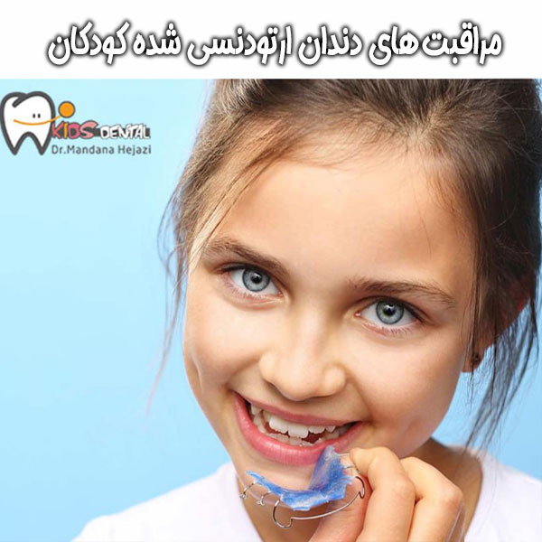 مراقبت از دندان ارتودنسی کشده کودکان در تهران با دکتر حجازی