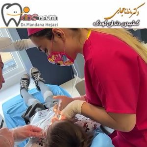 pediatric tooth extraction