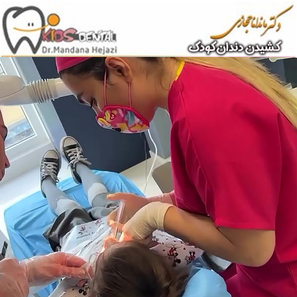 pediatric tooth extraction