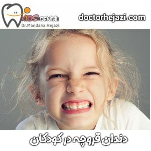 دندان قروچه در کودکان ، دکتر ماندانا حجازی در تهران