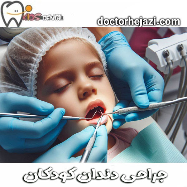 جراحی دندان کودکان از دکتر ماندانا حجازی ، بهترین متخصص دندانپزشک در تهران