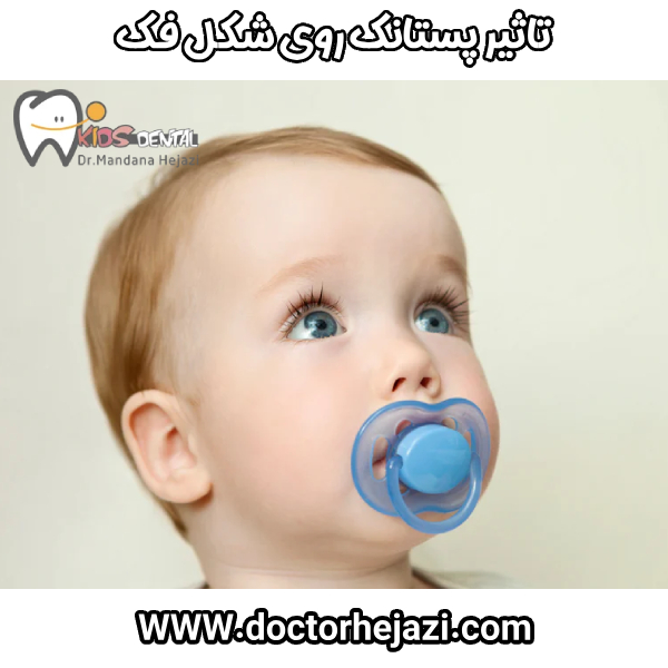 تاثیر پستانک روی شکل فک - دکتر ماندانا حجازی